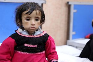 جزئیات یارانه غذایی دولت برای کودکان/ امکان برداشت نقدی در این طرح وجود ندارد