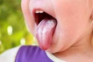 رنگ زبان چه چیزی را نشان می‌دهد/ ویدئو