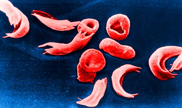 از اثبات ریاضیاتی جدید توسط دو دختر دانش آموز دبیرستانی تا امید به خوردن آسوده کیک با مصرف داروی ویگووی؛ ده رخداد از مهم‌ترین رخداد‌های علمی سال ۲۰۲۳