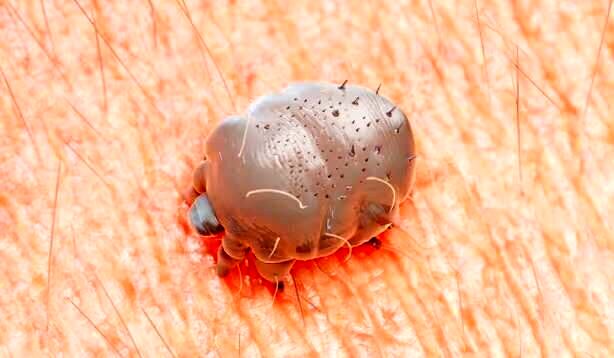 شیوع یک بیماری مُسری در انگلیس؛ متخصصان نگران کمبود دارو هستند