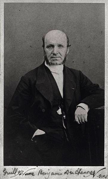 لبخند دوشن ؛ از الگویی برای لبخند واقعی تا تحقیقاتی که روی سرهای بریده انجام می شد! 4 لبخند دوشن ؛ از الگویی برای لبخند واقعی تا تحقیقاتی که روی سرهای بریده انجام می شد! (+عکس)