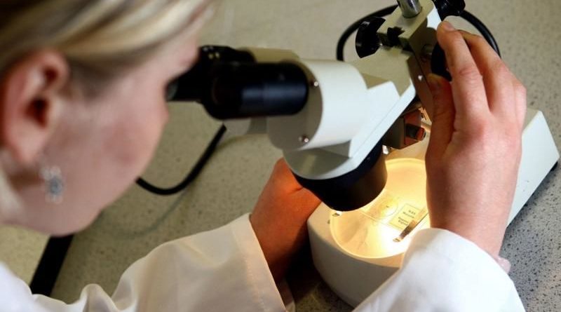 دانشمندان موفق به حذف ویروس HIV از سلول های آلوده شده‌اند