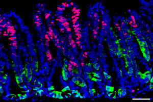 چگونه سلول‌های سرطانی از سیستم ایمنی پنهان می‌شوند