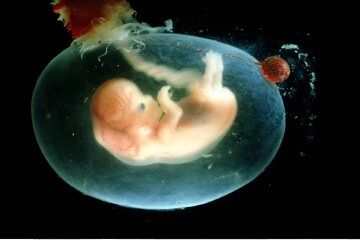 رژیم سالم مادران برای بارداری ۹ ماهه: ۵۰ هزار کالری غذایی_طلوع شرق 13 بارداری23.jpg