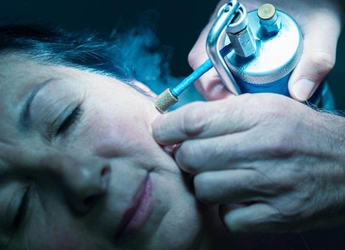 درمان سریع برای از بین بردن لک قهوه ای صورت_طلوع شرق 4 16f22e74-dd5c-44c5-9cb7-3504a96fdcec.jpg