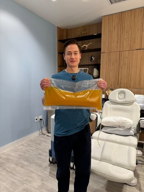 میلیاردر آمریکایی در سودای جوانی پلاسمای بدنش را معاوضه کرد!/ تصاویر_طلوع شرق 4 3