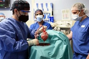 امیدی تازه در علم پزشکی؛ زنی با کلیه خوک رکورد طولانی‌ترین زندگی با عضو حیوانی را شکست