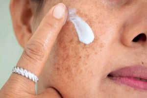 اگر پوست خشکی دارید علت آن کمبود این ویتامین‌ها است