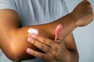 آیا افراد با پوست تیره هم به ضد آفتاب نیاز دارند؟