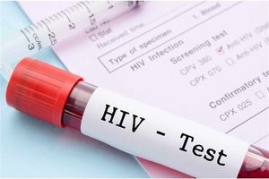 ویروس HIV دیگر نمی‌تواند پنهان شود