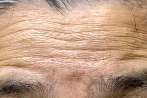 علت چروک شدن پوست با افزایش سن کشف شد_طلوع شرق علت چروک شدن پوست با افزایش سن کشف شد